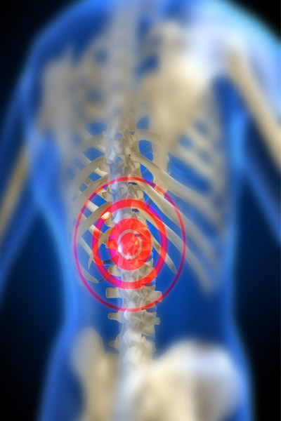 artritis psoriasica - Dr. gratacós